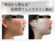 肌の土台構造から整えることで、戻らない小顔を造っていきます！
