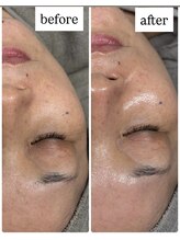 ユズドット(yuzu.)/肌悩み別の生ぷる美容液