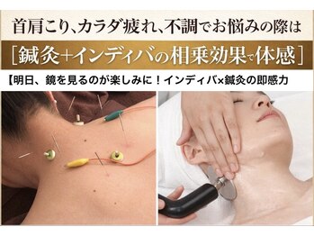 フィットジユウガオカ(Fit_Jiyugaoka)/冷え疲れ/肩こりにインディバ/鍼