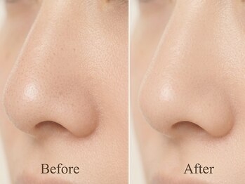 ばんこうろの写真/毛穴の黒ずみや詰まりに。表面だけでなく、肌全体の印象を整える毛穴ケア。透明感のある肌へ