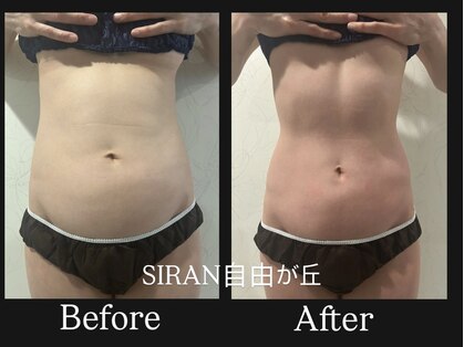 シラン(Siran)の写真