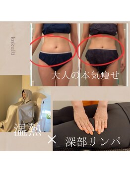 ヨサパーク コクリ(YOSA PARK kokuRi)の写真/洋服で体型を隠すのはもうおしまい!≪大人の本気痩せ、結果重視のサロンです♪≫初回特典多数あり☆