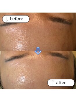 トータルビューティーサロンリア(Li'a)/ビフォー＆アフター