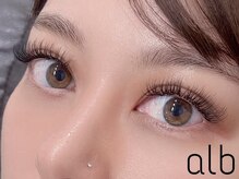 アルブ(alb)/バインドロック