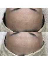 メイス 福井店(MEIS)/お客様Before、After