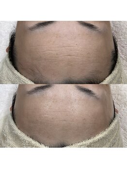 メイス 福井店(MEIS)/お客様Before、After