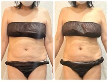 美容整体ウェリナ 名駅院/小顔矯正/骨盤矯正/痩身整体