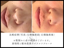 韓国肌管理室 ソア(soa)/【トロイピール】