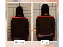 淀屋橋カイロプラクティックオフィス/一回で結果を