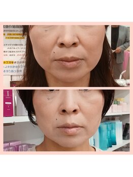 越前屋/細胞活性したら