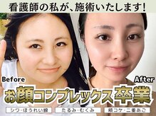 リノンクリニカル(LIINON clinical)