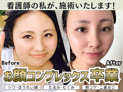 リノンクリニカル(LIINON clinical)の写真