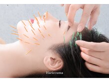 ハリックマ(HARICCUMA)