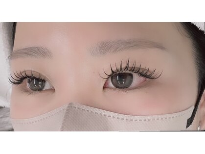 オミィ(OMIy)の写真