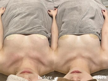 ティアモ(Ti Amo)/Before/After