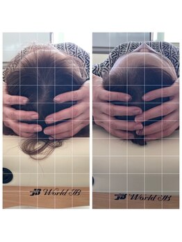 ムーナボーテ(Moona Beaute)/頭蓋骨調整!