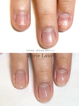 マリーロール 梅田店(Marie Laure)/自爪育成/深爪矯正/ネイルケア