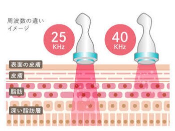 オアシス カナヤマ(Oasis kanayama)/【超強力☆キャビテーション】
