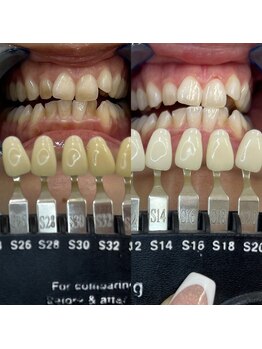 トウキョウスワーズ 池袋店(TOKYO SWRS)/#ホワイトニング #池袋 #渋谷