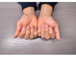 メンズネイル Before After