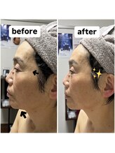 きれい塾 恵比寿/1回の施術結果