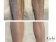 シエロ 赤坂店(Cielo)の写真/多くの男性からも支持☆＜シュガーリング＞面倒な毎日の自己処理からはもう卒業★清潔感のあるモテ肌へ