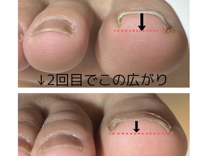ルアルネイル(Luar nail)の写真