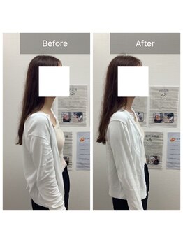 ハリナチュレ 那覇店(HARINATURE)/Before/After