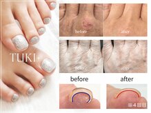 ツキ(TUKI+)の雰囲気（美肌育成ライトで手肌も若々しく。カラーができる巻き爪ケアも◎）