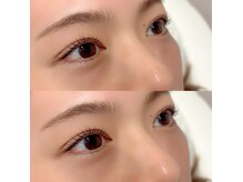 ビアス(VIAS)/まつ毛パーマ