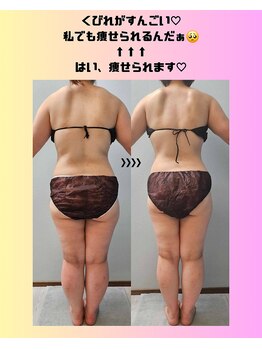 ルミルナ(Lumi Luna)/30代ダイエット
