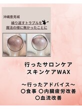 ハルハル(Haru Haru)/お顔の黒ずみ/毛穴ケア＼(^^)／