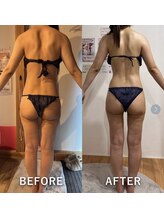 ベルフルール 浜松中野町店/セルゼロ痩身5回コース