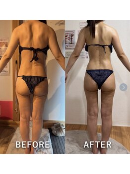 ベルフルール 浜松中野町店/セルゼロ痩身5回