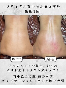 シーフェイス 横浜店(SEE FACE)/ブライダル上半身痩せドレス映え