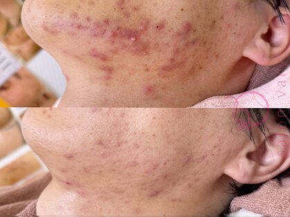 ヴェアリー 広尾(VARY)の写真