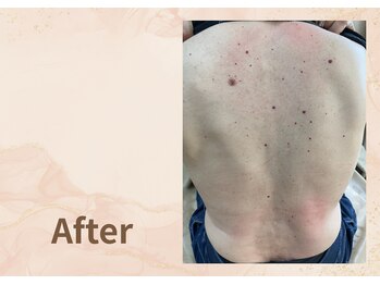 プラム(plum)/トーンヌール