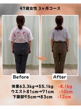 くさば整骨院/47歳女性/ダイエット3か月コース