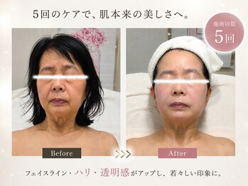 オレオマ(OLEOMA)の写真/【痛そうだけどいこうかな・・・】ちょっと待って!