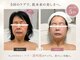 オレオマ(OLEOMA)の写真/【痛そうだけどいこうかな・・・】ちょっと待って!
