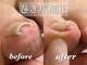 ルアナ 赤坂(LUANA)の写真/【トラブルフットケアマスター在籍】巻き爪・肥厚爪・タコ・魚の目等お悩みの方!!