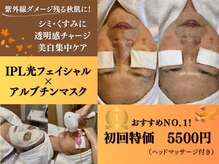 ノノキレイラボ(NONOKIREI LAB)の雰囲気（紫外線ダメージ残る秋肌に♪シミ・くすみ透明チャージ集中ケア！）