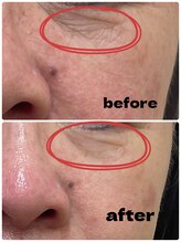 クレビア(Crebia)/第一印象は目元！！目元スッキリ