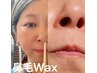 【フェイシャルワックス×鼻毛Wax】前回から1ヶ月半以降¥11400