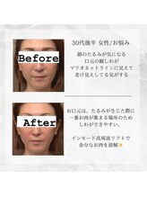 メディカルエステ 東銀座店/30代後半 女性