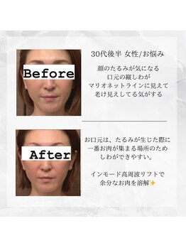 メディカルエステ 東銀座店/30代後半 女性