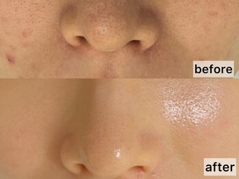 ユキエル(yukielle)