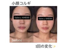 サロンワイアネシス(Salon y ANESIS)の雰囲気（小顔コルギ1回の変化/名古屋コルギ/久屋大通コルギ/小顔リンパ）