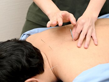 たくみ整骨院 綱島西口院/整体/鍼灸/美容鍼/マッサージ