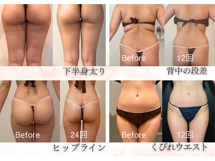 ピッコロ(piccolo)の写真